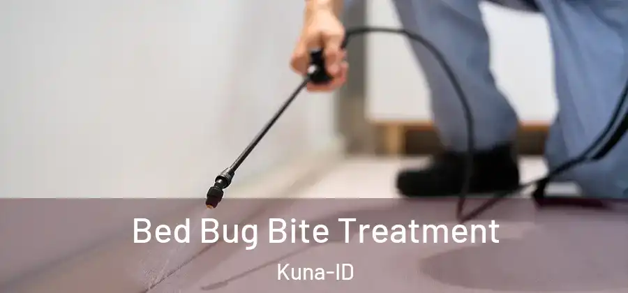  Bed Bug Bite Treatment Kuna-ID